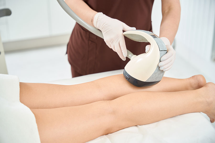 Tratamiento VelaSmooth para reducción de celulitis en Maristegui, centro de estética en Pozuelo de Alarcón